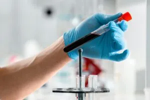 Baza Wiedzy i Eksperckie Kompendia – Vivaleo Diagnostyka parametrów jelitowych i markerów zapalnych